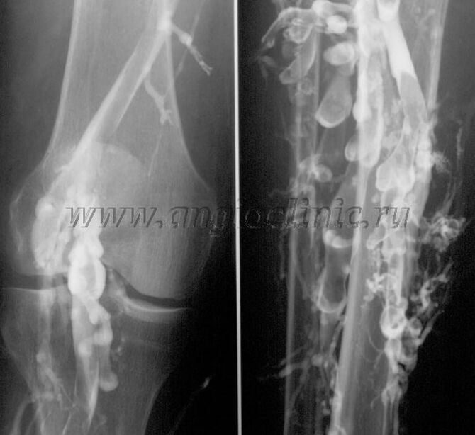 Ultrasound examination
